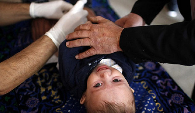 Circumcision
