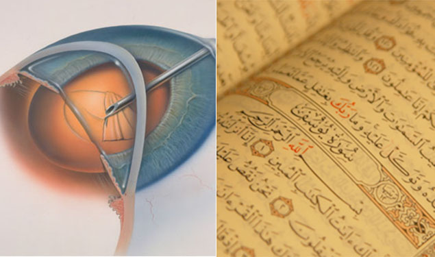 Quran Cataracts