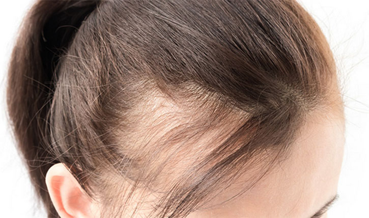 Hair Regrowth on Wounded Skin