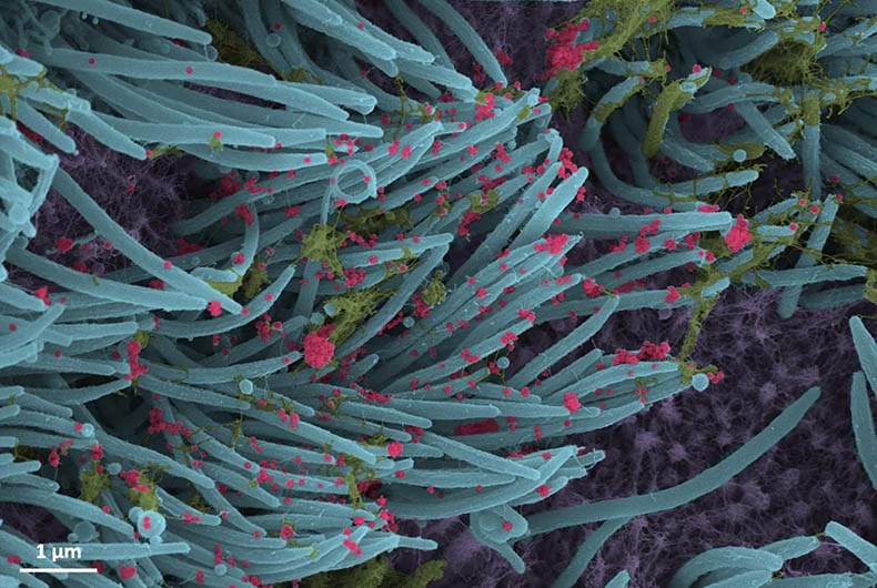 Covid Virus in Retina