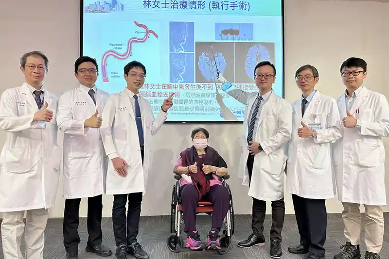 This AI system detects acute ischemic stroke in 90 seconds