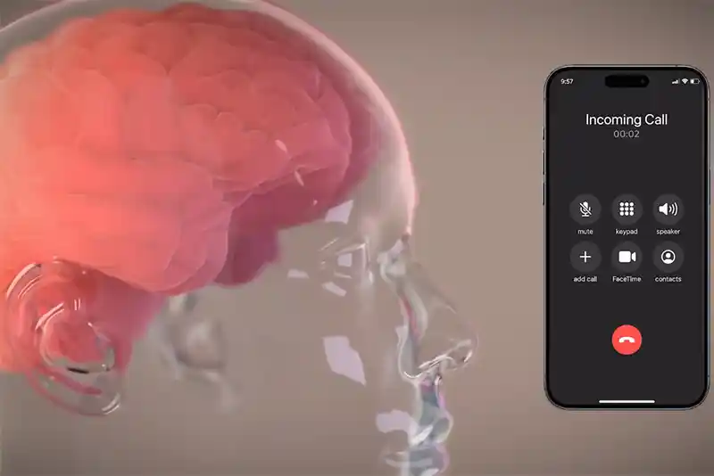 ‘Neuron spike detected’: Elon Musk claims 1st successful brain implant